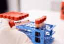 Método de detecção do vírus da dengue